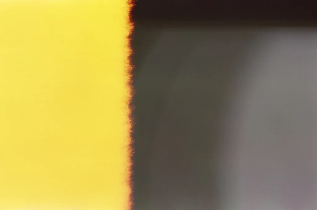 Photo Botox smile lines